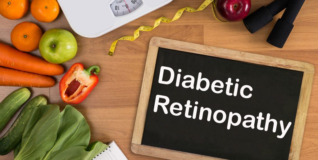 Foods to Prevent Diabetic Retinopathy